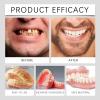 Full Set Dentures, Premium Dentures Full Set, Generation Flexible Full Denture Solution, Silicone Custom Dentures Teeth Top and Bottom, Full Denture Set Custom Flexible False Teeth (3Pcs) view 4