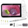 Digital Ear Camera, HD Otoscope with 5 Inch Screen for Photo and Video Recording, Ideal for Home Ear Examination and Health Monitoring view 1