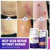 Temviey Advanced Scar Gel, Skin Repair Cream for Surgical Scars, Burn, Acne Scar Treatment, Stretch Mark Cream Effective for Both Old and New Scars 50ML view 2