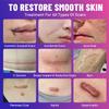 Temviey Advanced Scar Gel, Skin Repair Cream for Surgical Scars, Burn, Acne Scar Treatment, Stretch Mark Cream Effective for Both Old and New Scars 50ML view 3