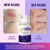 Temviey Advanced Scar Gel, Skin Repair Cream for Surgical Scars, Burn, Acne Scar Treatment, Stretch Mark Cream Effective for Both Old and New Scars 50ML view 4