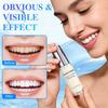 Tooth Stain Removal Colour Corrector, Naturalness Tooth whitening Gel Paint, Instant Teeth Whitening Paint & Polish Kit, Tooth Polishing Kit for Sensitive Teeth,White Tooth Paint Tooth Polish (5) view 4