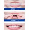 Teeth Cleaning Strips, Gentle Stain Removal, Brightens Teeth, Hypoallergenic Formula, Home Use, No Instruments Required, Fresh Mint Flavor, 14 Strips view 2
