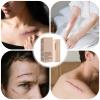 Scar Repair Stick - Silicone Remover for Skin | Smooth Gel for Old New Marks, Healing Tool for Raised Keloid, Daily Care for Stretch Burns C Section Sensitive Areas view 4