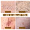 CRAFTHROU Waterproof Cover Tape Concealer Scar Silicone for Redness, Skin-friendly up Sticker and Body Makeup Suitable for Fitness and Makeup Bag Use view 3