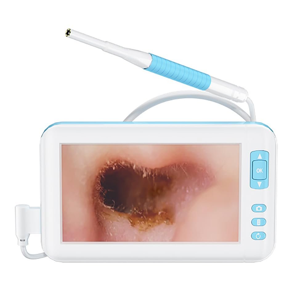 Digital Otoscope Camera, 3.9MM Earwax Removal Tool, 1080P Lens, 4.3 Inch Display, 6 LED Lights, Video Support for Adults, Children, and Pets