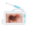 Digital Otoscope Camera, 3.9MM Earwax Removal Tool, 1080P Lens, 4.3 Inch Display, 6 LED Lights, Video Support for Adults, Children, and Pets view 1