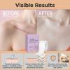 Collagen Tape, 2026 Professional Silicone Scar Patches, Silicone Scar Removal Strips for Various Scars and Wrinkles, Silicone Scar Plasters Against Wrinkles, for All Skin Types view 3