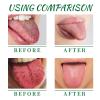 Tongue Repair Spray, Dry Mouth Spray, Oral Antibacterial, Instant Relief for Dry Mouth, Mint Breath Freshener, White Coating Removal, Moisturizing & Bad Breath Cure view 4