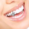 Mekalero Shining Star Single Tooth Grillzs for Men and Women Allergy Resistant Alloy Removable Toothjewely for Parties and Concerts Hip Hop Tooth Jewelry view 2
