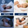 48Pcs Sleep Patches for Adults & Kids view 4