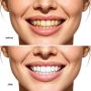 Gum Repair Gel, Strengthens Teeth and Protects Enamel Gel, Gum Care Gels for Receding Gums, Remineralization Teeth Protect G/el, Refresh Breath Oral Care Gels, Gentle Teeth Brighting Ge/l (6pcs) view 3